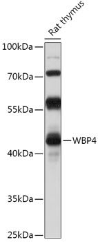 Western blot