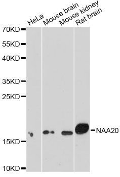 Western blot - NAA20 Polyclonal Antibody (144-07105)