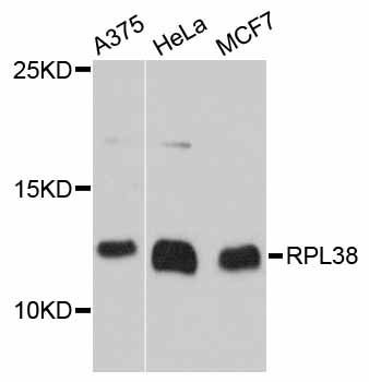 Western blot - RPL38 antibody (144-012038)