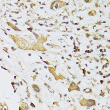 Immunohistochemistry - GPD2 Antibody (144-06611)