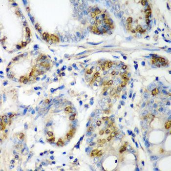 Immunohistochemistry - CRYAA antibody (144-05725)