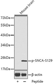 Western blot