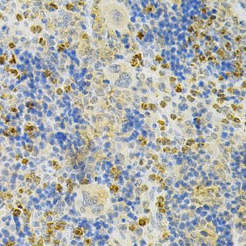 Immunohistochemistry - TNFRSF11B Polyclonal Antibody (144-02100)