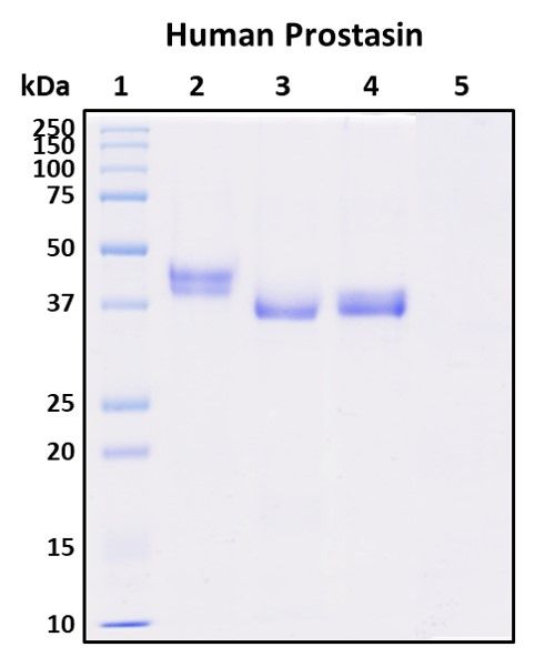 SDS-PAGE