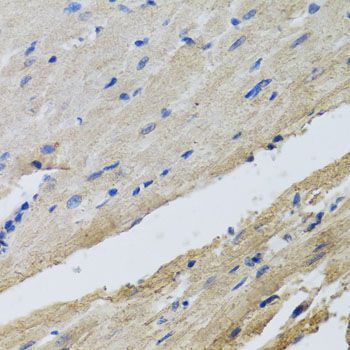 Immunohistochemistry - FECH antibody (144-08418)
