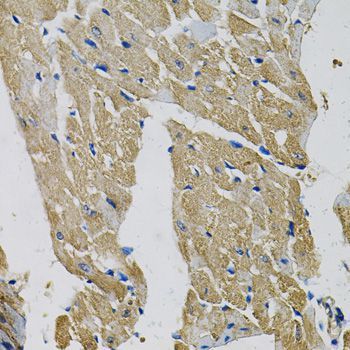 Immunohistochemistry - EIF3H Polyclonal Antibody (144-013378)