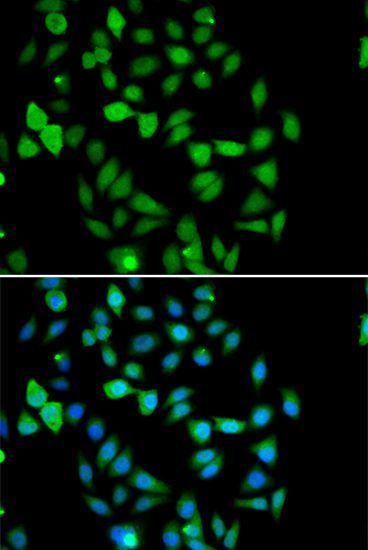 Immunohistochemistry - STAMBP Polyclonal Antibody (144-07065)