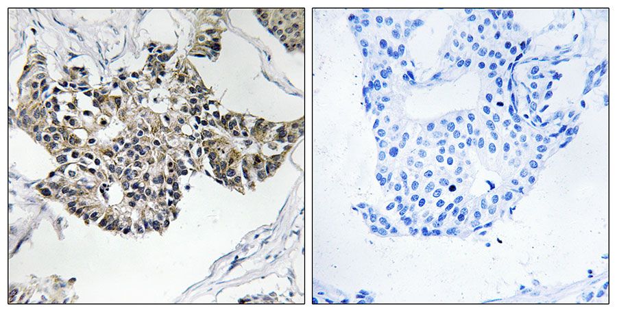 IHC