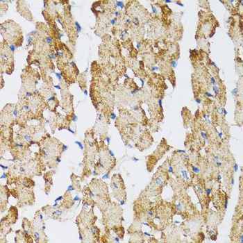 Immunohistochemistry - Caspase3 Polyclonal Antibody (144-60067)