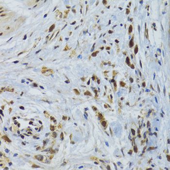 Immunohistochemistry - GABPB1 Polyclonal Antibody (144-06909)