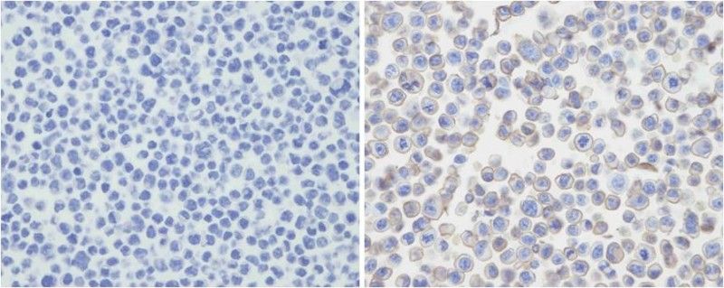IHC-P