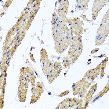 Immunohistochemistry - MRPL12 antibody (144-08318)