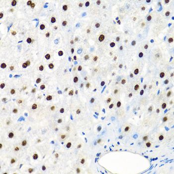 Immunohistochemistry - SSB Polyclonal Antibody (144-00630)