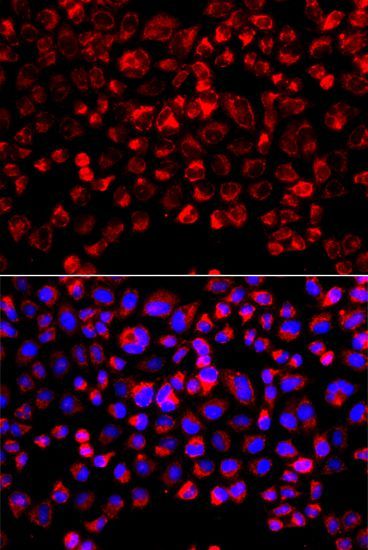 Immunofluorescence - SULT1E1 Polyclonal Antibody (144-07452)