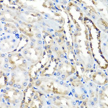 Immunohistochemistry - HYAL1 antibody (144-06623)