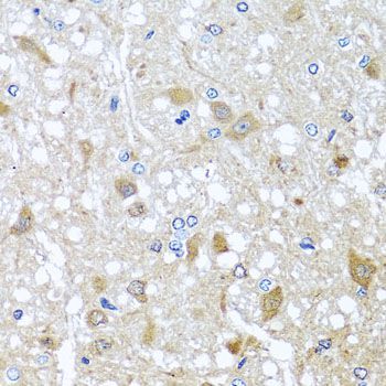 Immunohistochemistry - EFHC1 antibody (144-08002)