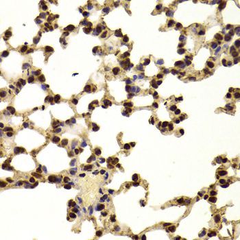 Immunohistochemistry - AAAS Antibody (144-06427)