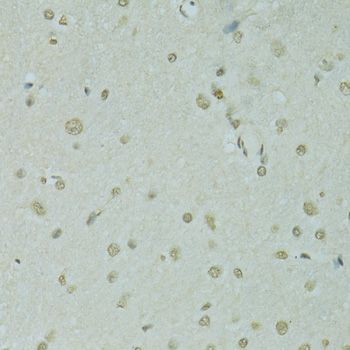 Immunohistochemistry - SAFB antibody (144-07927)