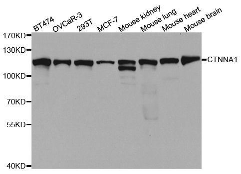 Western blot - CTNNA1 Polyclonal Antibody (144-05635)