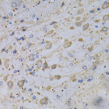 Immunohistochemistry - GAD2 Polyclonal Antibody (144-00971)