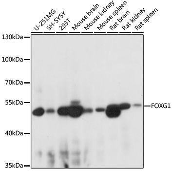 Western blot