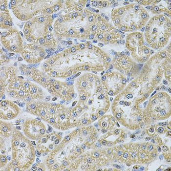 Immunohistochemistry - IFI16 Antibody (144-60546)