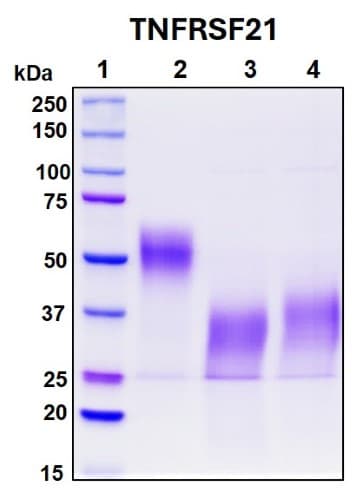 SDS-PAGE Image