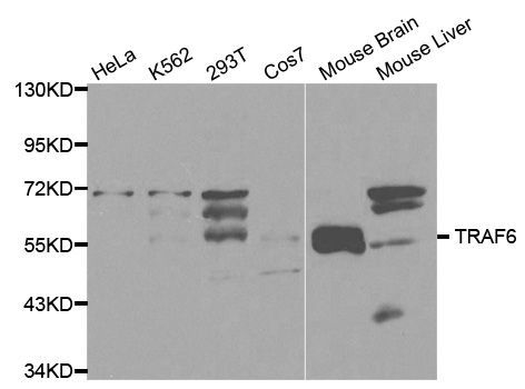 Western blot - TRAF6 Polyclonal Antibody (144-00973)