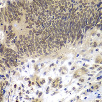 Immunohistochemistry - CEBPG Polyclonal Antibody (144-07279)