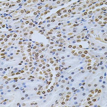 Immunohistochemistry - ILK Polyclonal Antibody (144-00901)