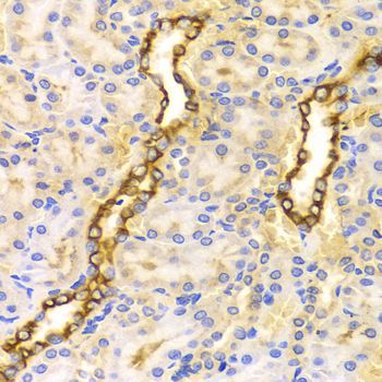 Immunohistochemistry - CPT2 antibody (144-02876)
