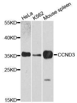 Western blot - [KO Validated] CCND3 Polyclonal Antibody (144-00746)