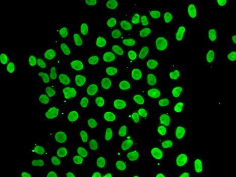 Immunofluorescence - QKI Polyclonal Antibody (144-07043)