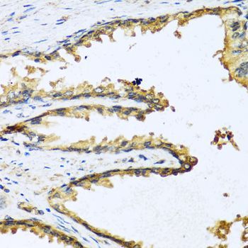 Immunohistochemistry - GNRH1 antibody (144-05625)