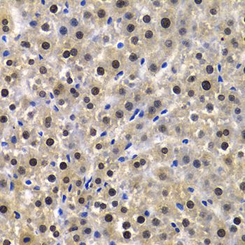 Immunohistochemistry - KPNA4 Antibody (144-02026)