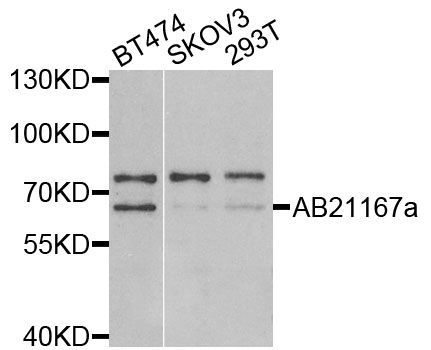 Western blot - PSMD3 Polyclonal Antibody (144-02790)