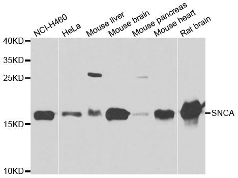 Western blot - SNCA Polyclonal Antibody (144-07215)