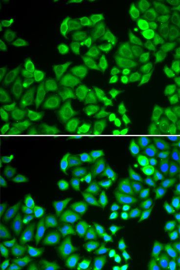 Immunofluorescence - PPP4C antibody (144-60378)