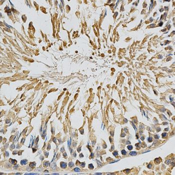 Immunohistochemistry - CYP1A1 antibody (144-02159)