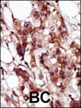 IHC-P