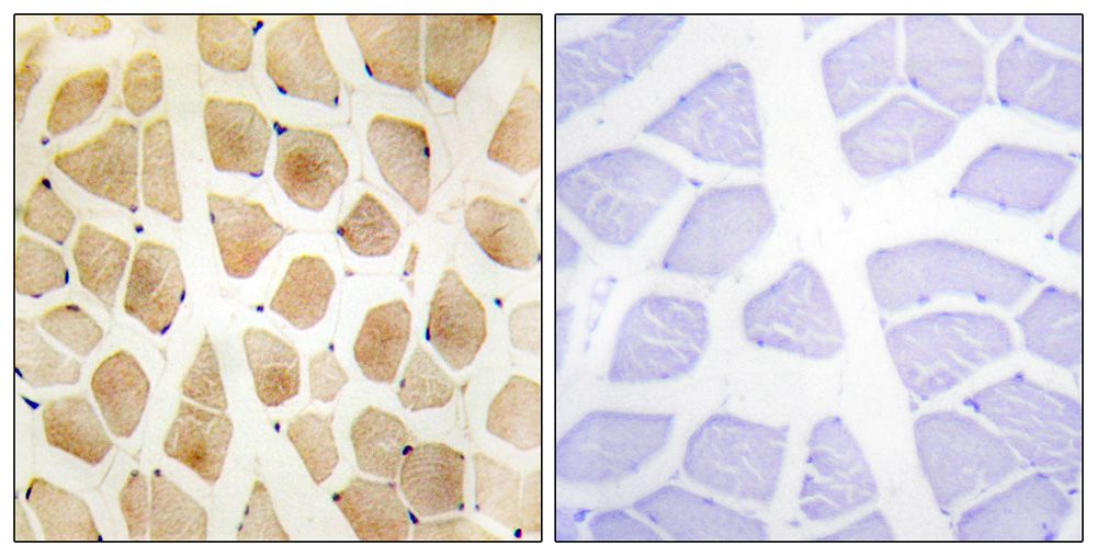 IHC