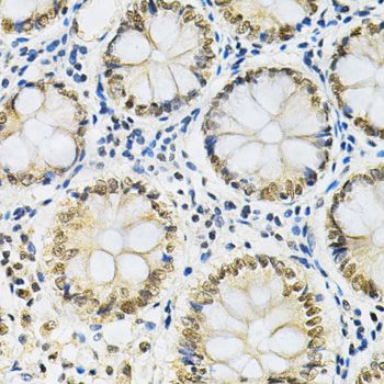 Immunohistochemistry - SNRPE Antibody (144-05488)