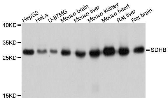Western blot - SDHB Polyclonal Antibody (144-10821)