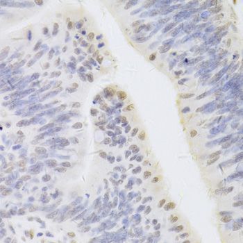 Immunohistochemistry - HDGF Antibody (144-05347)