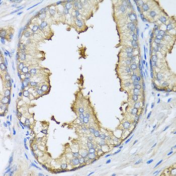 Immunohistochemistry - ATG5 Polyclonal Antibody (144-00203)