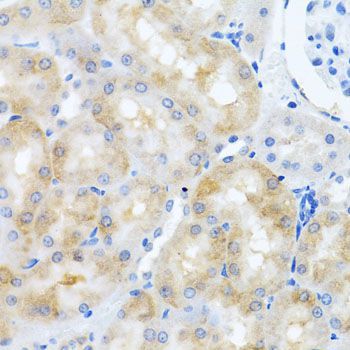 Immunohistochemistry - SCO1 antibody (144-06734)