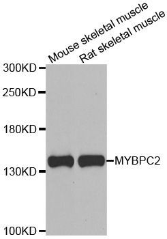 Western blot - MYBPC2 antibody (144-06934)