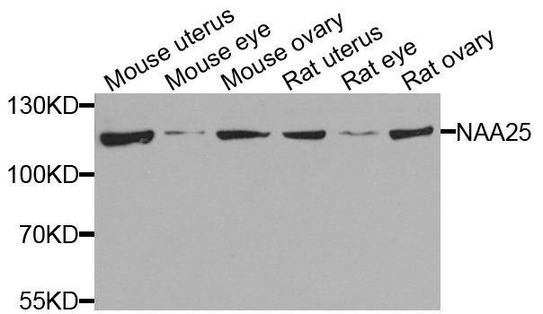 Western blot - NAA25 antibody (144-08516)