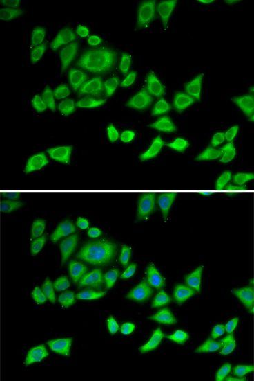 Immunofluorescence - OGDH antibody (144-012477)