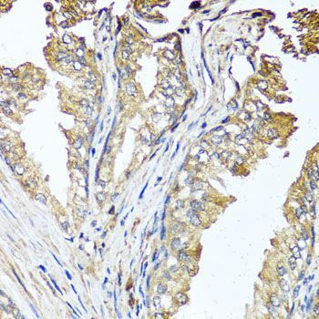 Immunohistochemistry - STK3 Polyclonal Antibody (144-06992)